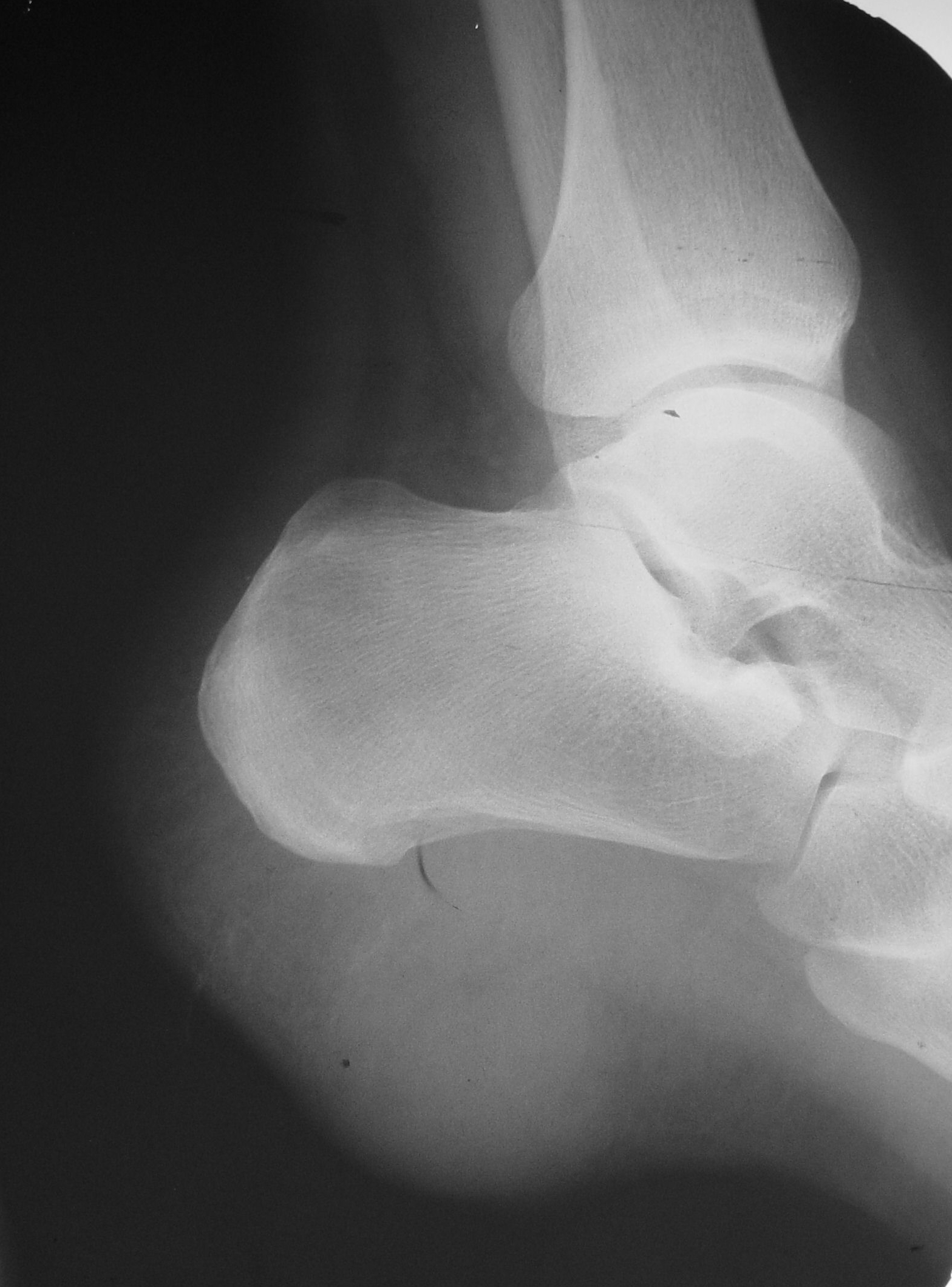 UCSD Musculoskeletal Radiology